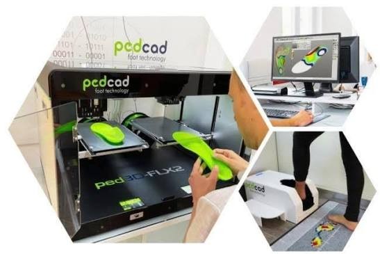 Járásanalízis és egyedi 3D talpbetét gyártás pedcad rendszerrel